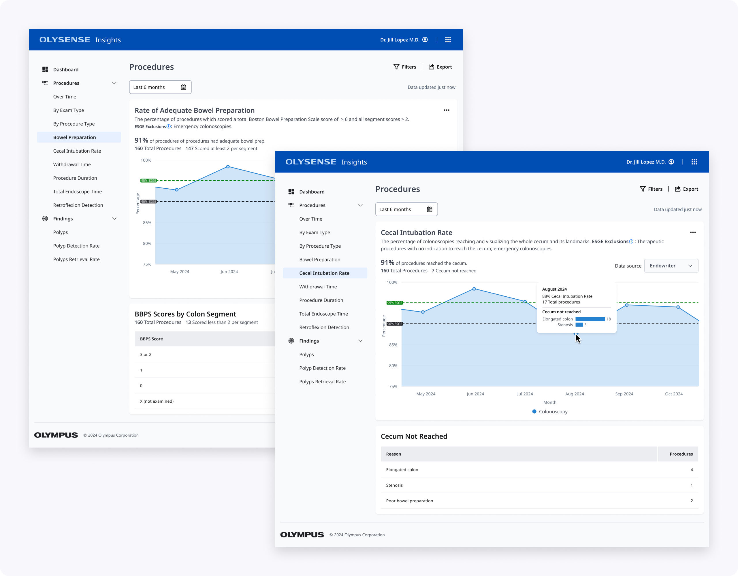 final bbps and cir final designs