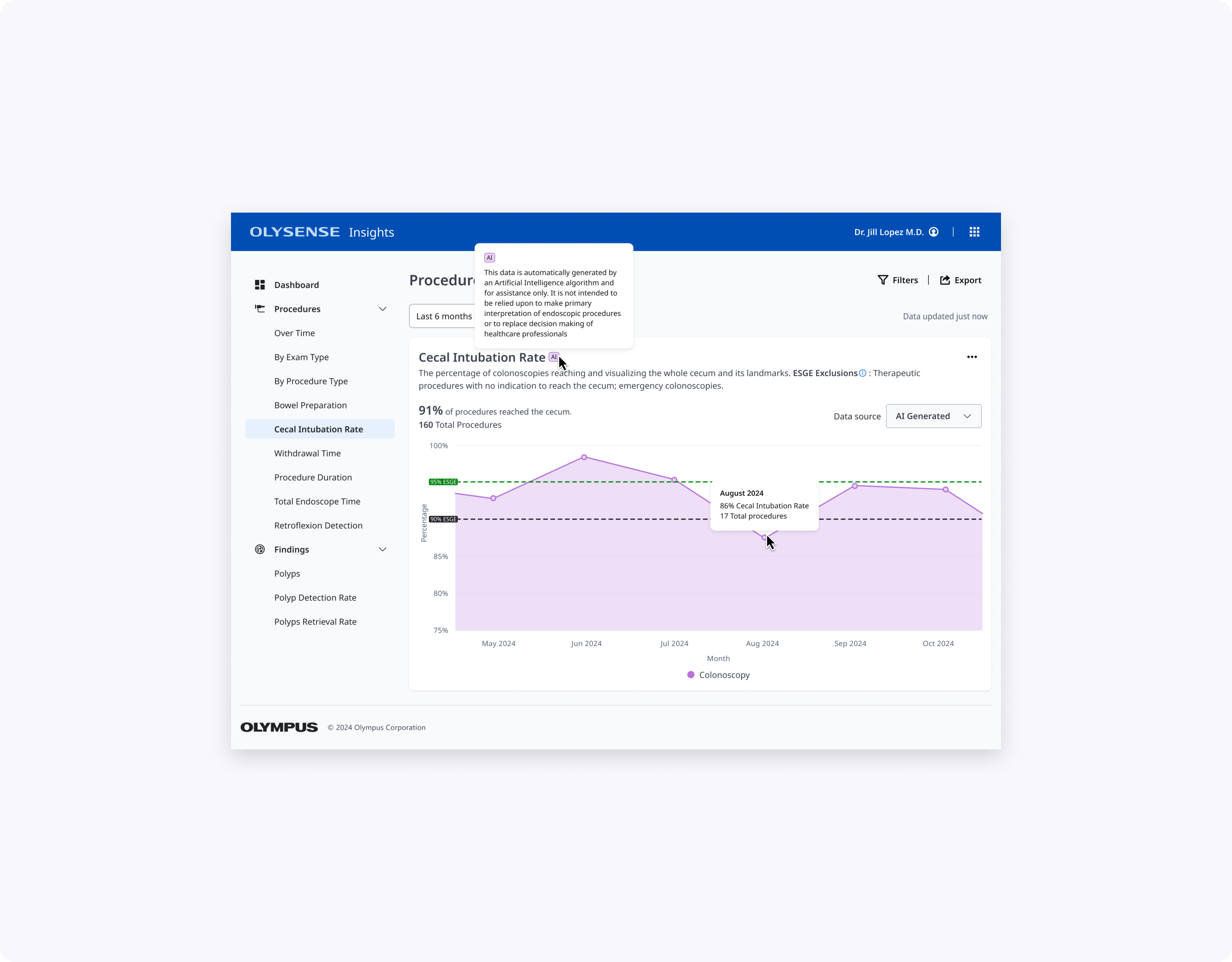 final cir caq page view