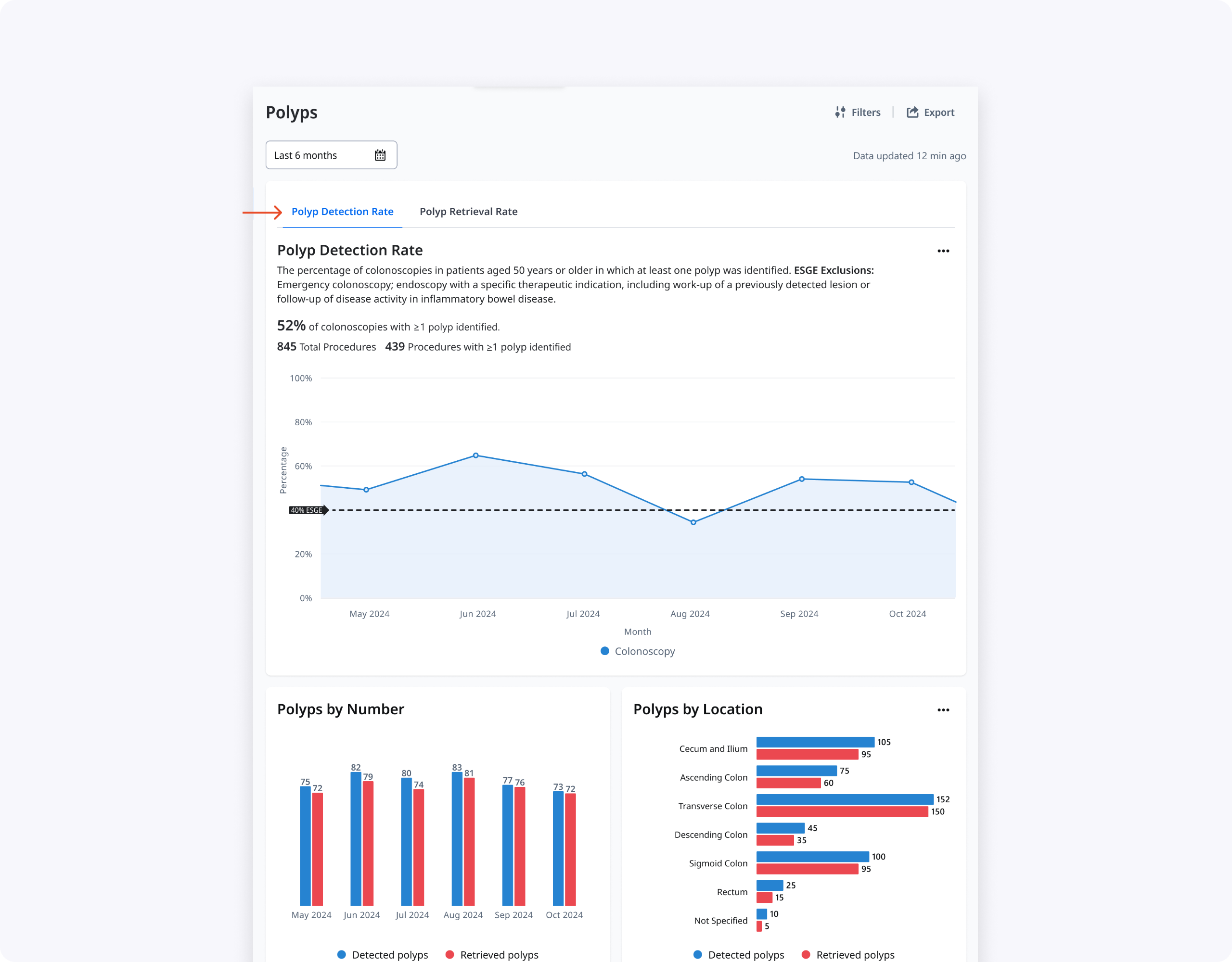 hi-fi concept 1 PDR tab, main chart and graphs