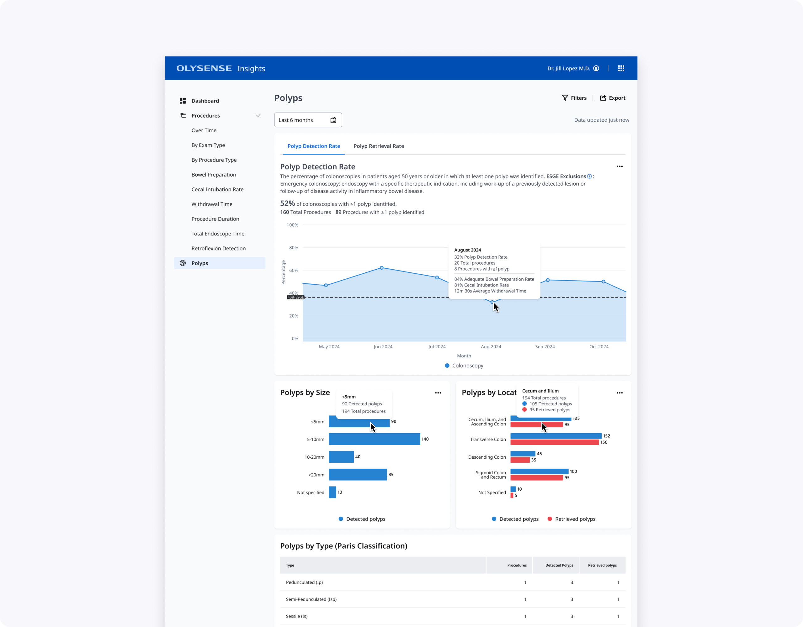 final polyps metrics page PDR